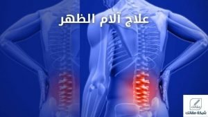 علاج آلام الظهر