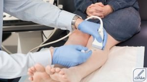 علاج دوالي الساقين